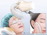 【成飞医院科普】一文详解光子嫩肤→强脉冲光