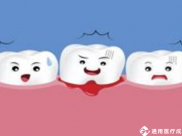 【成飞医院科普】牙龈出血怎么办？