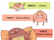 【成飞医院科普】什么是肺结节？