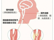 【成飞医院科普】颈动脉超声造影：揪出血管里的“隐形杀手” 预防脑卒中