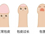 【成飛醫(yī)院科普】暑假“包”治煩惱指南：解鎖丁丁的夏日煥新計(jì)劃！