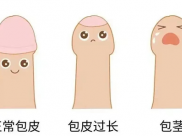 【成飛醫(yī)院科普】暑假“包”治煩惱指南：解鎖丁丁的夏日煥新計(jì)劃！
