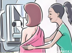 【成飞医院科普】“乳”此重要——不能忽视的乳腺钼靶检查
