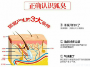 【成飞医院科普】告别腋臭尴尬，清爽自信一夏